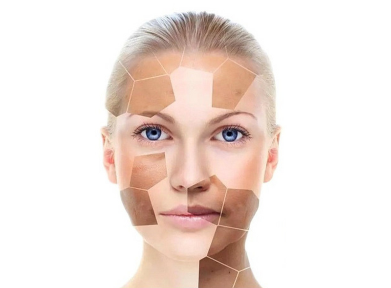 El arte de iluminar tu rostro: cómo reducir manchas, aclarar y despigmentar la piel