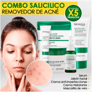 Kit/Combo x 5 Ácido Salicílico Anti-Acné | Tratamiento Facial Para El Acné - BIOAQUA - Lunaurea | Skincare, Maquillaje, Cosméticos