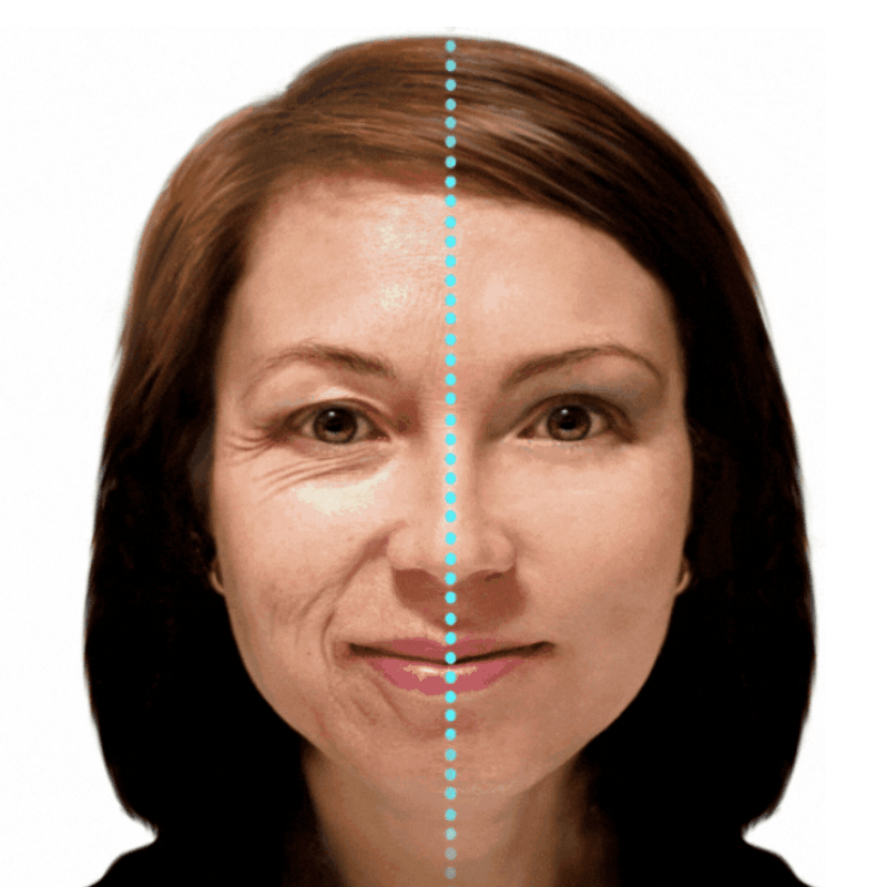 Ácido Hialurónico LB | Reduce Arrugas | Tratamientos LB SAS - Lunaurea | Skincare, Maquillaje, Cosméticos