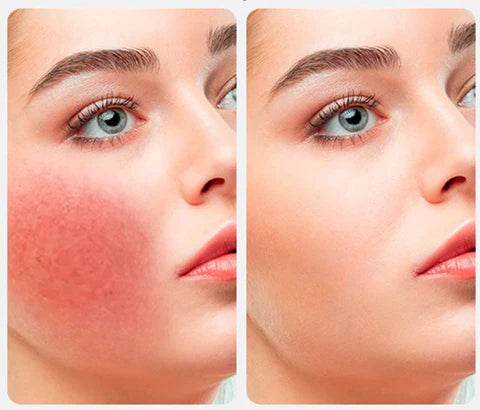 Molde de Silicona Para Hielo | Masajeador Facial con Hielo - Lunaurea | Skincare, Maquillaje, Cosméticos