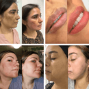 Crema Aclarante y Despigmentante Íntimo BIOAQUA - Lunaurea | Skincare, Maquillaje, Cosméticos