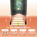 Depiladora Láser IPL: Luz Pulsada [Alta Capacidad: 999.999 Mil Disparos] - Lunaurea | Skincare, Maquillaje, Cosméticos