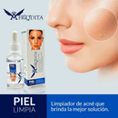 Tónico Anti-Acné - Afrodita - Lunaurea | Skincare, Maquillaje, Cosméticos