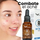 Retinol 0.5% (Vitamina A) | Tratamiento Anti-Edad - Afrodita - Lunaurea | Skincare, Maquillaje, Cosméticos
