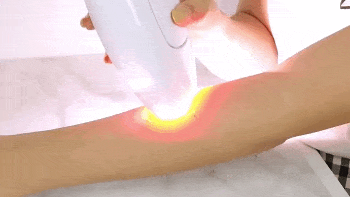 Depiladora IPL Premium [Alta Capacidad: 600 mil disparos] - Tienda Ellas: Maquillaje y Cosméticos