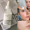 The Ordinary Niacinamide 10% + Zinc 1% (30ml) | Sérum Vitamina B3 - Lunaurea | Skincare, Maquillaje, Cosméticos