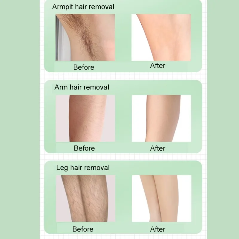 Cuidado Facial y Corporal Depiladora IPL + Gafas de Sol + Rasuradora [Pack 3 en 1]